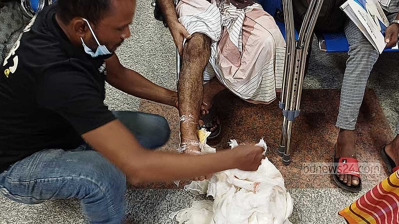 Shafiqul Islam, a patient at NITOR, was unable to open his foot plaster as the nurses were on strike. Finding no other way, his brother tried to unfold the plaster cast.