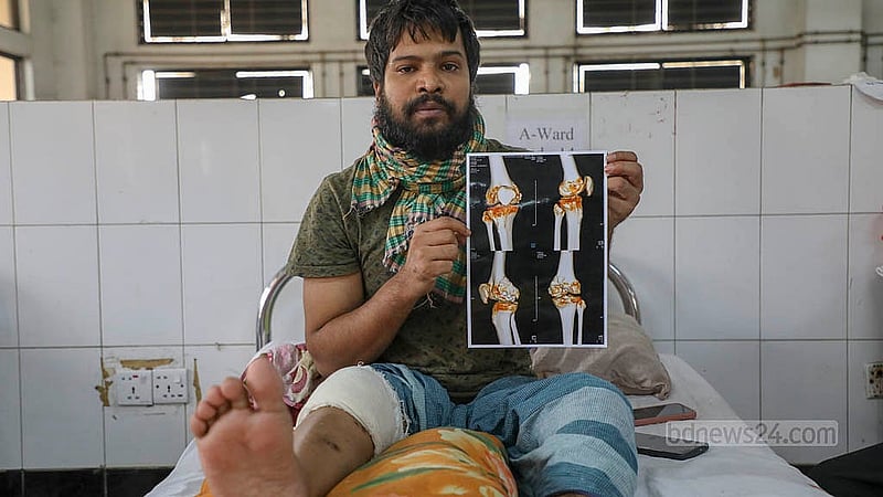 An injured activist displays a photo of his leg X-ray as he rests. Photo: Mahmud Zaman Ovi