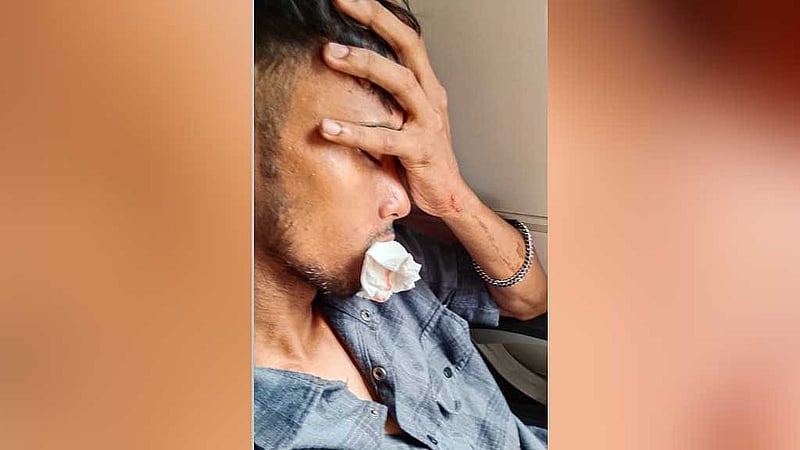 Passenger Himel Ahmed, injured after a stone smashed into the Cox's Bazar Express.