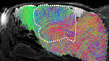 Scientists transplant lab-grown human brain tissue into mice