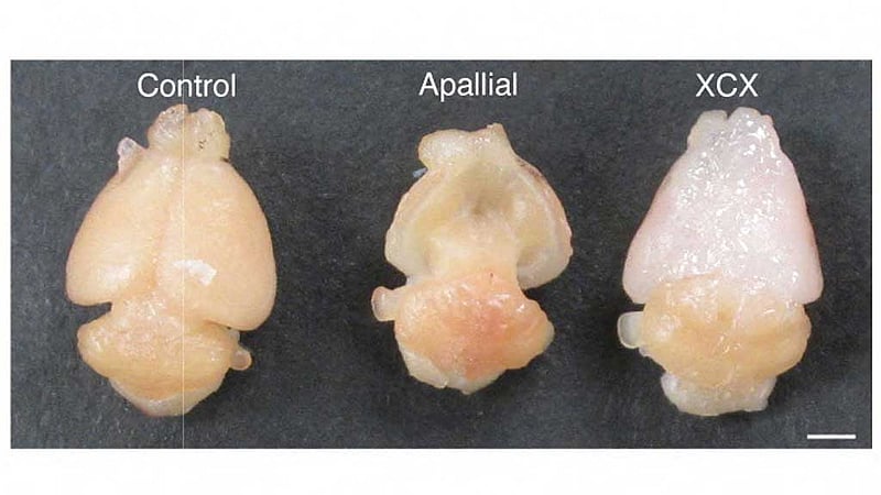 A top-down view of brains from an ordinary laboratory mouse, an experimental "apallial" mouse bioengineered to lack 98 percent of the cortical and hippocampal tissue found in ordinary mice and an experimental "xenocortical" mouse bioengineered to lack 98% of the cortical and hippocampal tissue found in ordinary mice that has received a transplant of a cortical organoid of laboratory-grown human brain tissue. Scale bar is 2mm. The image was released by Stanford University in Stanford, California, US, Sept 16, 2026. Photo: Reuters
