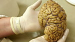 Scientists map gene activity in crucial brain region