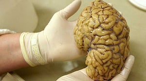 Scientists map gene activity in crucial brain region