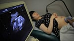 Chinese doctors shrink  fetal lung tumour without surgery in world first