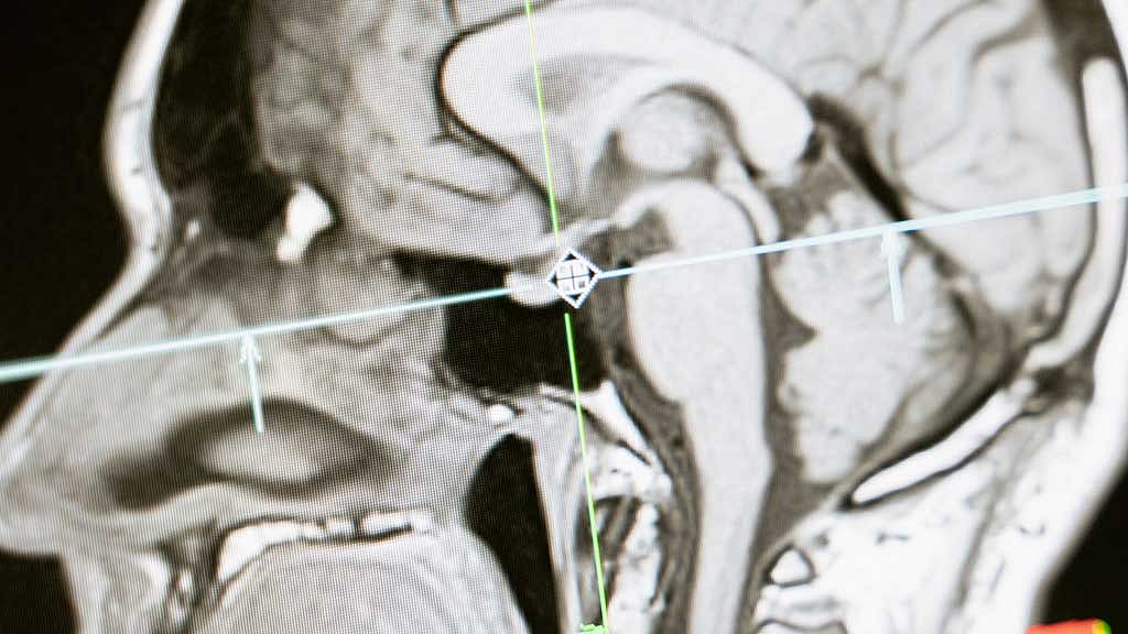 Study links brain enzyme to stronger memory in ageing mice, cognitive resilience in humans