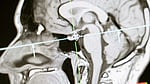 Brain enzyme may help preserve memory in old age: study