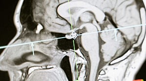 Brain enzyme may help preserve memory in old age: study
