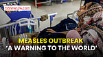 Bangladesh’s measles crisis offers ‘a warning to the world’ on vaccines