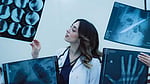 Four signs of osteoporosis women should know