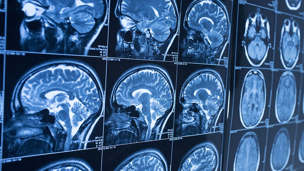 Brain-computer interfaces decode attempted speech into words for people with paralysis: report