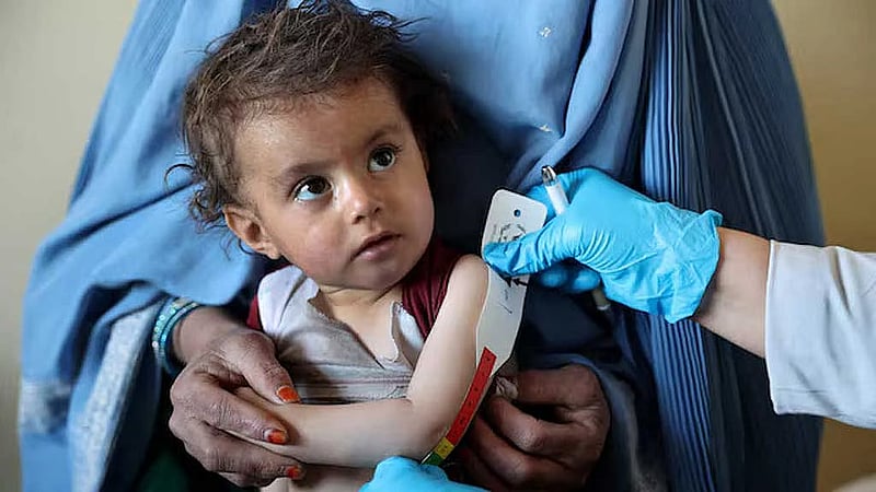 Afghan child malnutrition surges as aid cuts force clinics to turn families away, WFP says