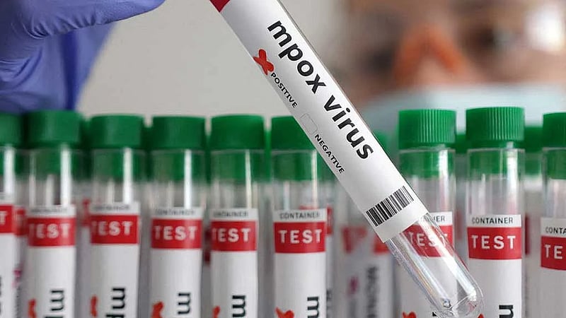 Uganda confirms two more cases of mpox