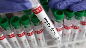 Senegal reports mpox case, patient in isolation