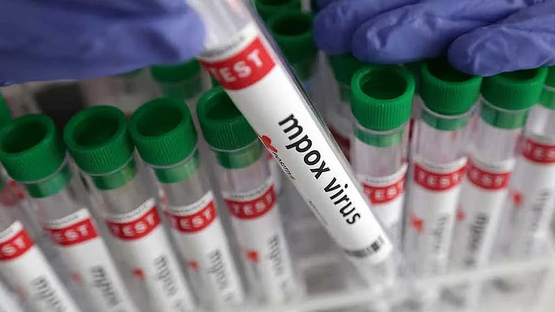 Senegal reports mpox case, patient in isolation
