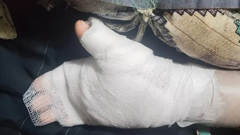 Mumbai tutor burns 8-year-old's hand with candle for ‘bad handwriting’