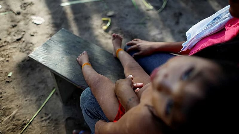 Scientists try to prove link between Amazon gold mining and disabilities in babies