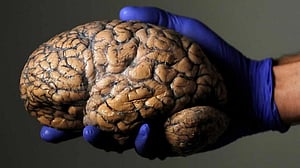 Scientists unveil first draft of atlas of the developing brain