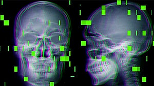 As AI enters the operating room, reports arise of botched surgeries and misidentified body parts