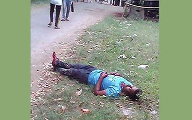 RU BCL activist's foot chopped off