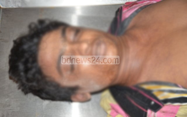 Boy dies from terrible injuries after ex-employer pumps air into his body in Khulna