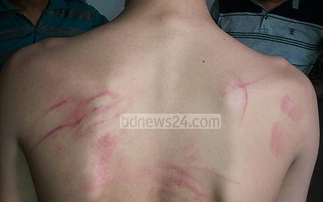 পরীক্ষার হলে ‘কথা বলেছিল’ ছেলেটি