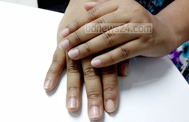 নখের স্বাস্থ্য ভালো রাখতে