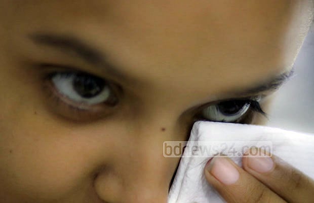 চোখের চাপ কমানোর উপায়