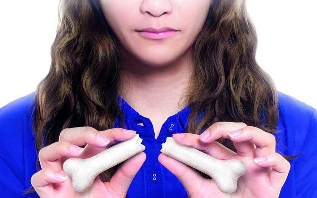হাড় ক্ষয় এড়াতে সচেতন হতে হবে কম বয়সেই