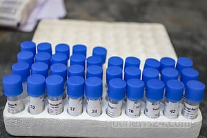 কোভিড: শনাক্ত ২০৭, মৃত্যু ২ জনের