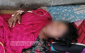 খুলনায় গৃহবধূকে ‘অ্যাসিড’ নিক্ষেপ, মামলা