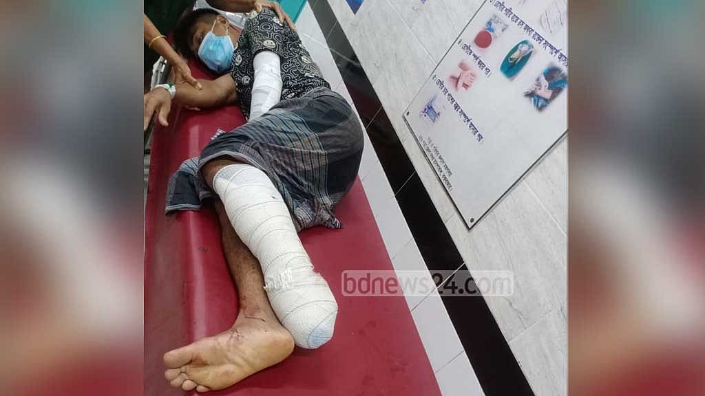 মিয়ানমার সীমান্তে ‘মাইন’ বিস্ফোরণে বাংলাদেশি আহত