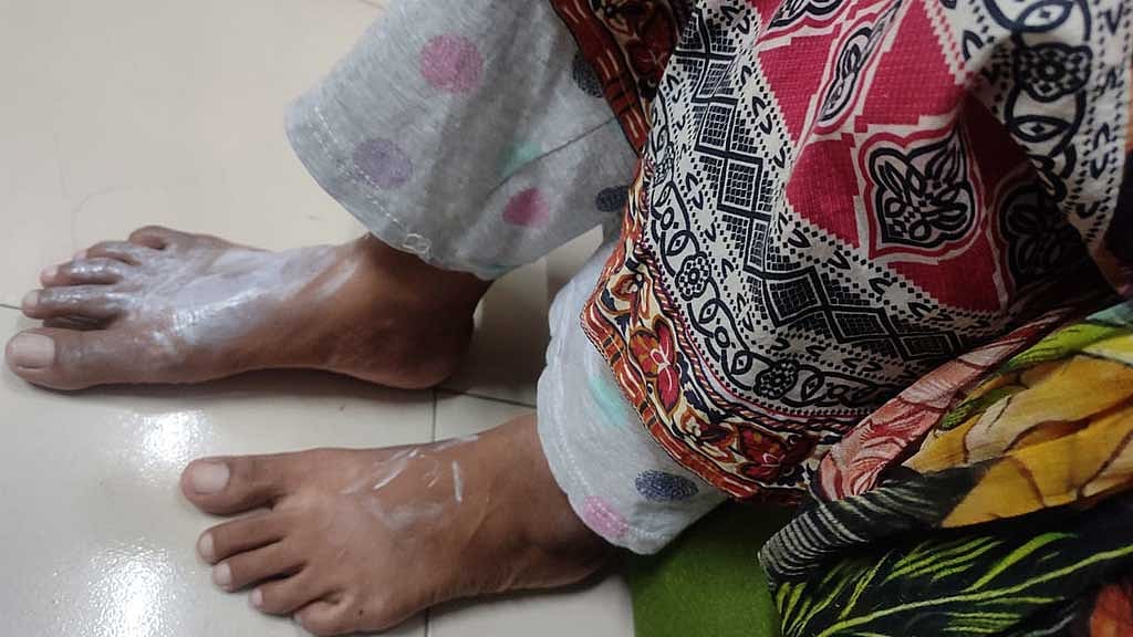 ইডেন শিক্ষার্থীর পায়ে চা ঢেলে নির্যাতনের অভিযোগ