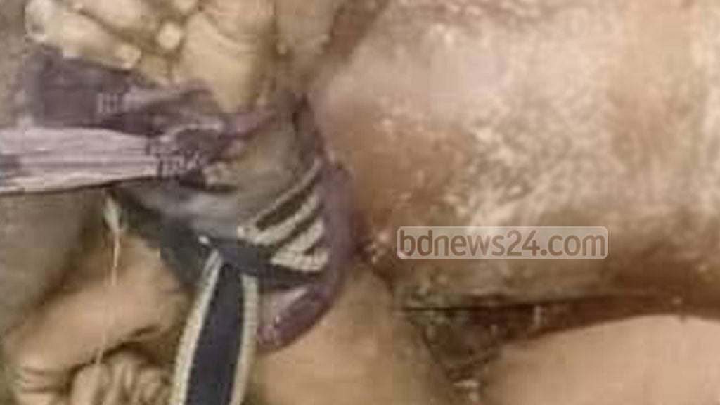 ঝোপে মিললো টমটম চালকের হাত-পা বাঁধা লাশ