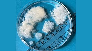 কেমন দেখতে গর্ভকালের প্রথম দিকের ভ্রুণ?