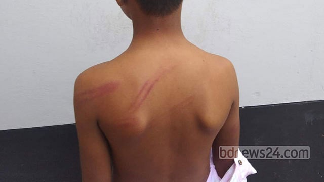 ভোলায় চুরির অপবাদে স্কুলছাত্রকে বেঁধে নির্যাতন