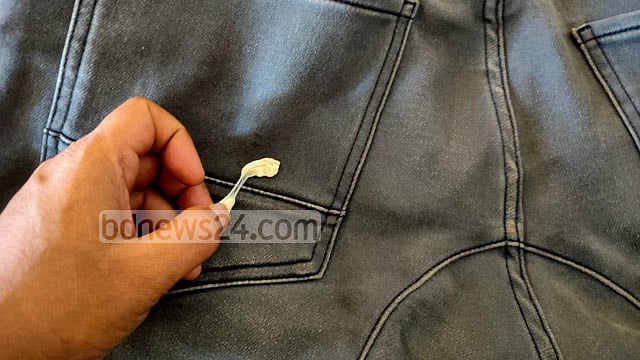 কাপড় থেকে চুইংগাম ওঠানোর উপায়