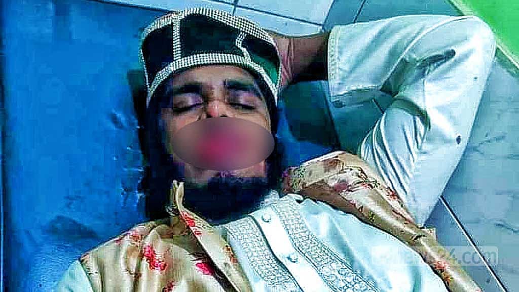 ব্রাহ্মণবাড়িয়ায় মাহফিল শেষে বক্তার উপর হামলা, কেটেছে জিহ্বা