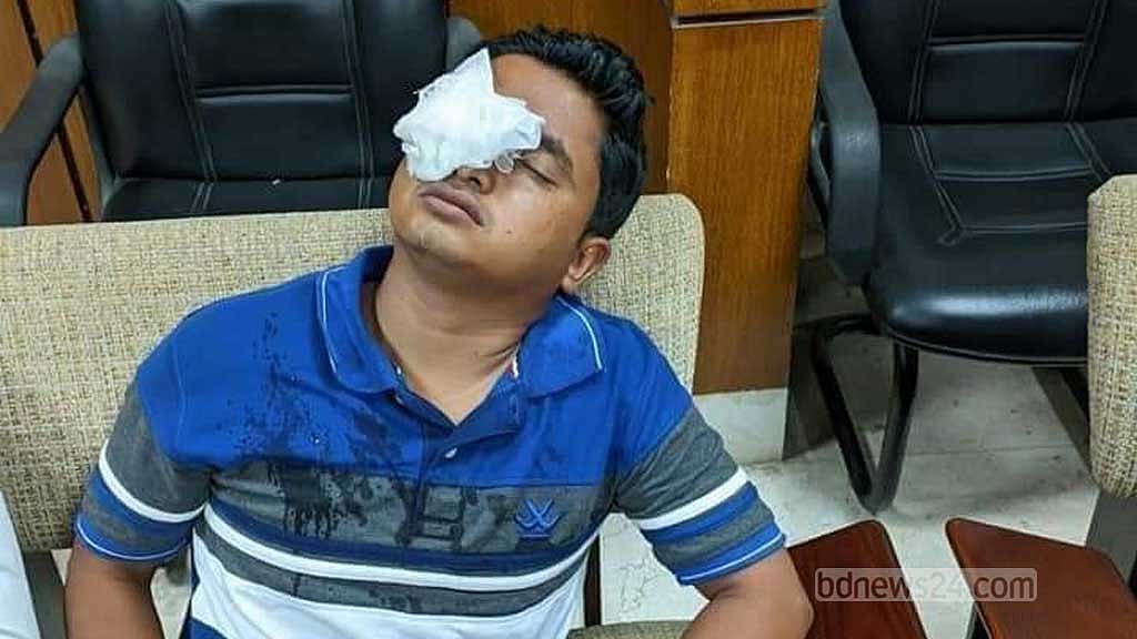 ট্রেনে ছোড়া ঢিলে চোখ হারাতে বসেছেন চাকরিপ্রত্যাশী তরুণ