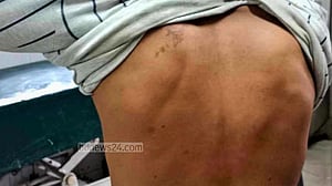 ফেনীতে ‘মারধরের ছবি তোলায়’ হামলার শিকার সাংবাদিক