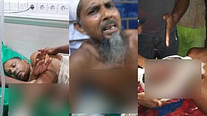 গোপালগঞ্জে ইউপি সদস্যসহ ৩ ভাইকে কুপিয়ে জখম