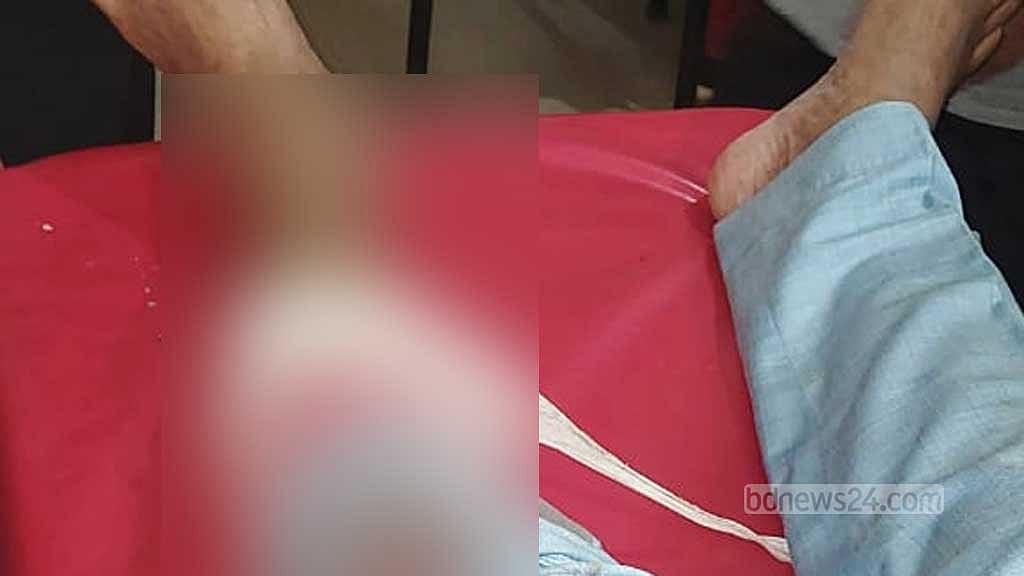 চৌদ্দগ্রামে আওয়ামী লীগের পাল্টাপাল্টি, মুক্তিযোদ্ধাকে কুপিয়ে জখম