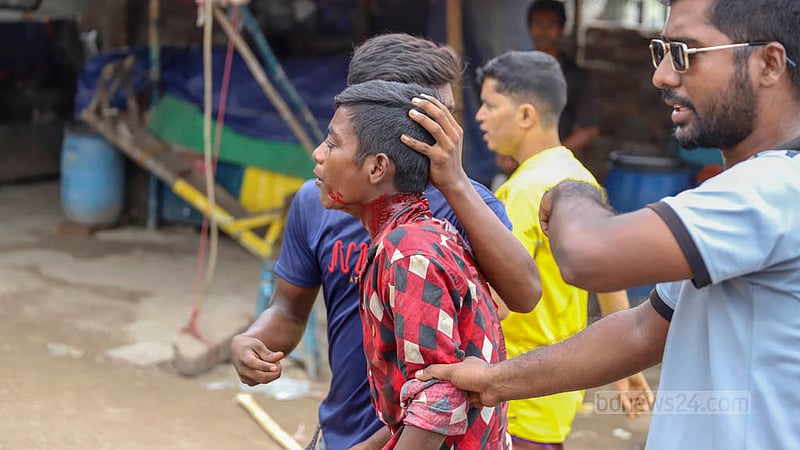 গাবতলীতে শনিবার বিএনপি-আওয়ামী লীগ নেতা-কর্মীদের সংঘর্ষের ঘটনায় আহত এক পথচারী।&amp;nbsp;ছবি: আসিফ মাহমুদ অভি