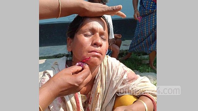 নীলফামারীতে শেয়ালের কামড়ে শিশুসহ আহত ৬