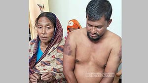 যশোরে রিকশাচালককে নির্যাতনের অভিযোগ র‌্যাবের বিরুদ্ধে