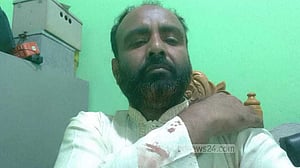 শামীম ওসমানের আসনে ‘হামলায়’ আহত সুপ্রিম পার্টির প্রার্থী