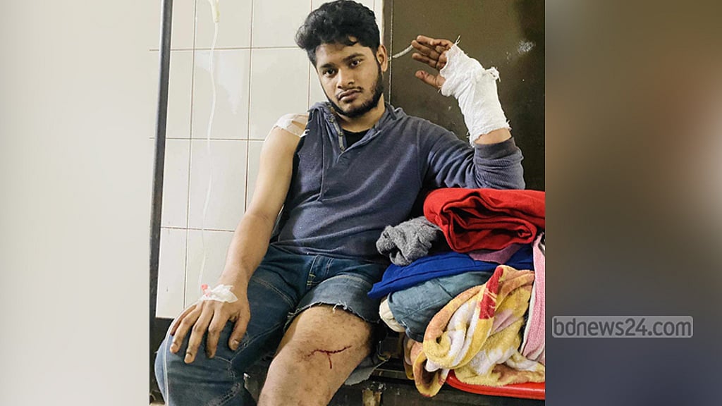 ছিনতাইকারীর ছুরিতে জবি শিক্ষার্থী আহত