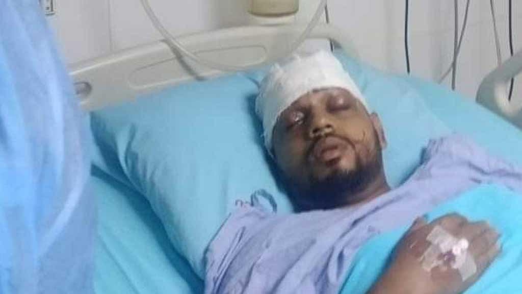 ঢাবিতে ছাত্রলীগের দুই পক্ষে মারামারি, আইসিউতে একজন