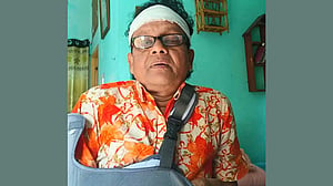 ডাল কাটতে গিয়ে ছাদ থেকে পড়ে আহত কণ্ঠশিল্পী নকুল বিশ্বাস