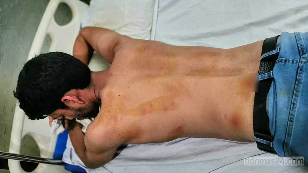 নজরুল বিশ্ববিদ্যালয়ের ২ সাংবাদিককে পেটানোর অভিযোগ ছাত্রলীগের বিরুদ্ধে