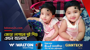 দুই শিশু আলাদা: ‘যুগান্তকারী’ বলছেন স্বাস্থ্যমন্ত্রী